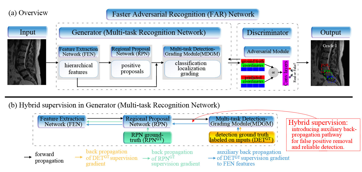The multi-task recognition-diagnosis network that recognizes critical vertebrae and diagnoses spondylolisthesis gradings in an adversarial manner.